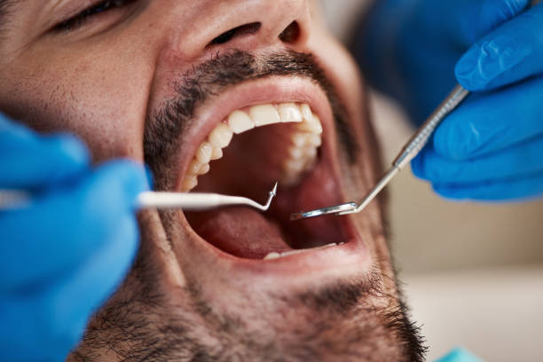 Best Emergency Treatment for Oral Infections in Hughes Springs, TX